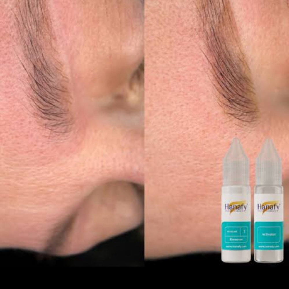 FREE Virtual Removal Consultation