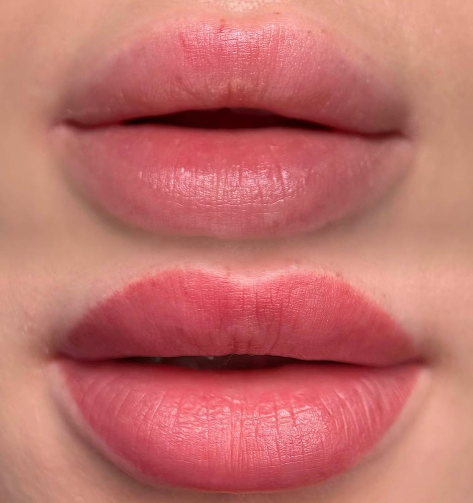 Lips Touche Up  < 2 Months