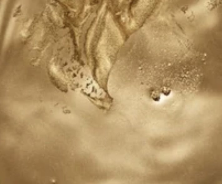 Nasolabial (Smile Lines)