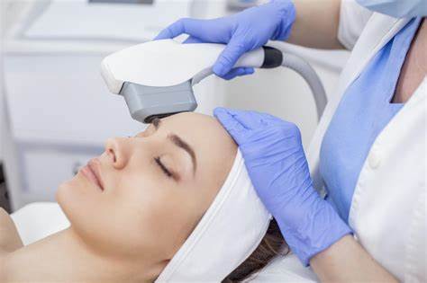 IPL (Impulsed Light Therapy)