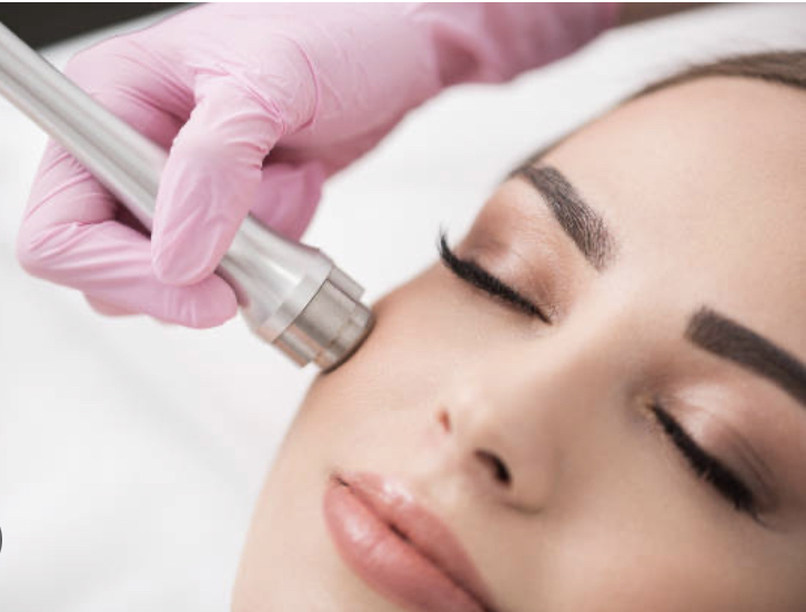 Microdermabrasion