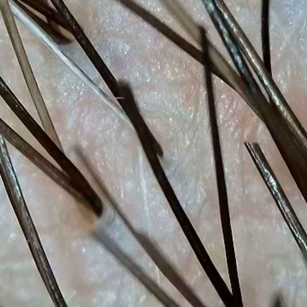 Scalp Treatment at Ashley  Allred in Orem, UT