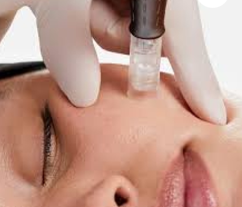 Nanoneedling Facial