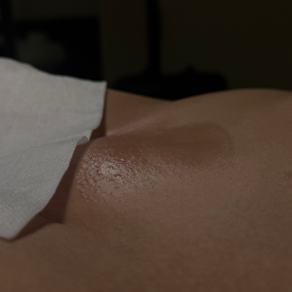 Bikini Full ( V ) Female Wax at MaliaSkin in Paradise Valley, AZ