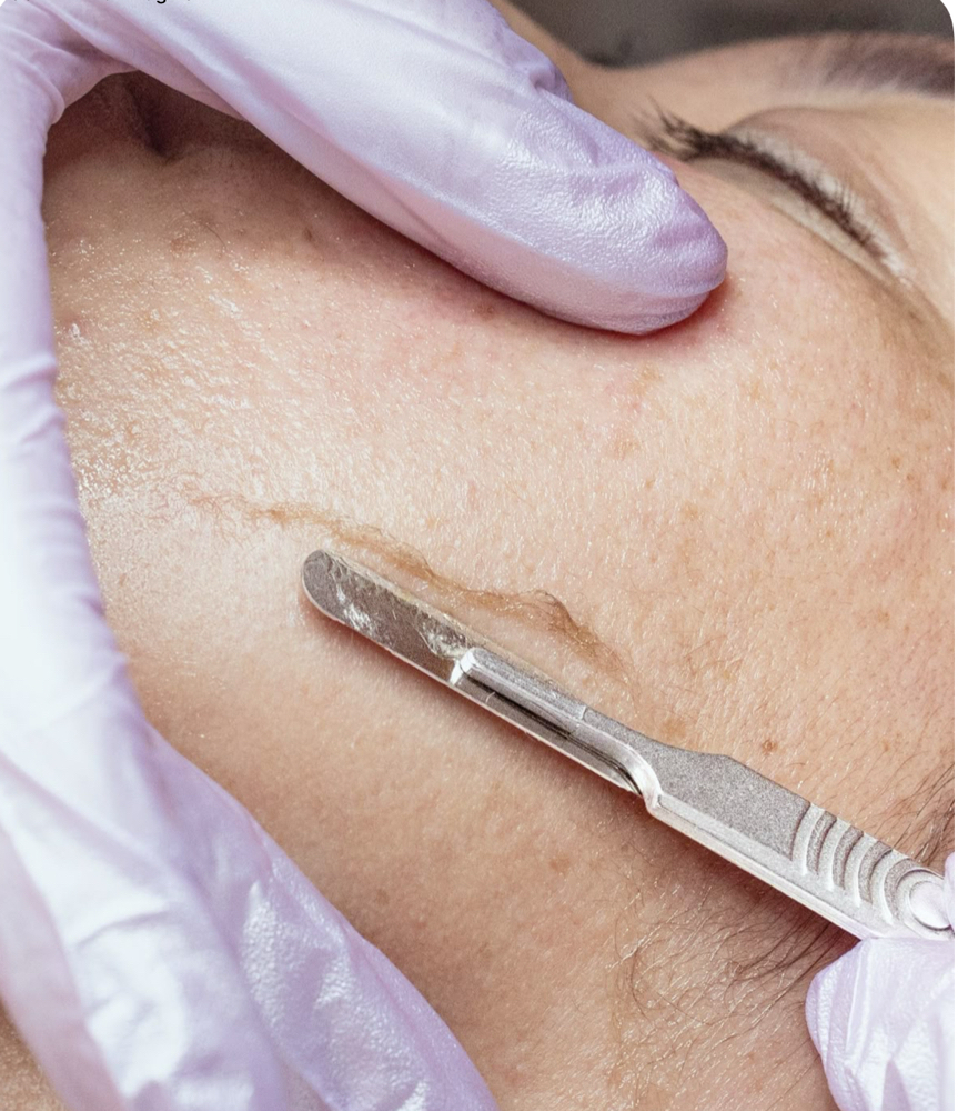 Dermaplane Add-On at Ur Bestie the Esthie in CA, CA