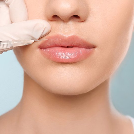 1/2 syringe Lip Filler at Athena Med Spa in San Antonio, TX