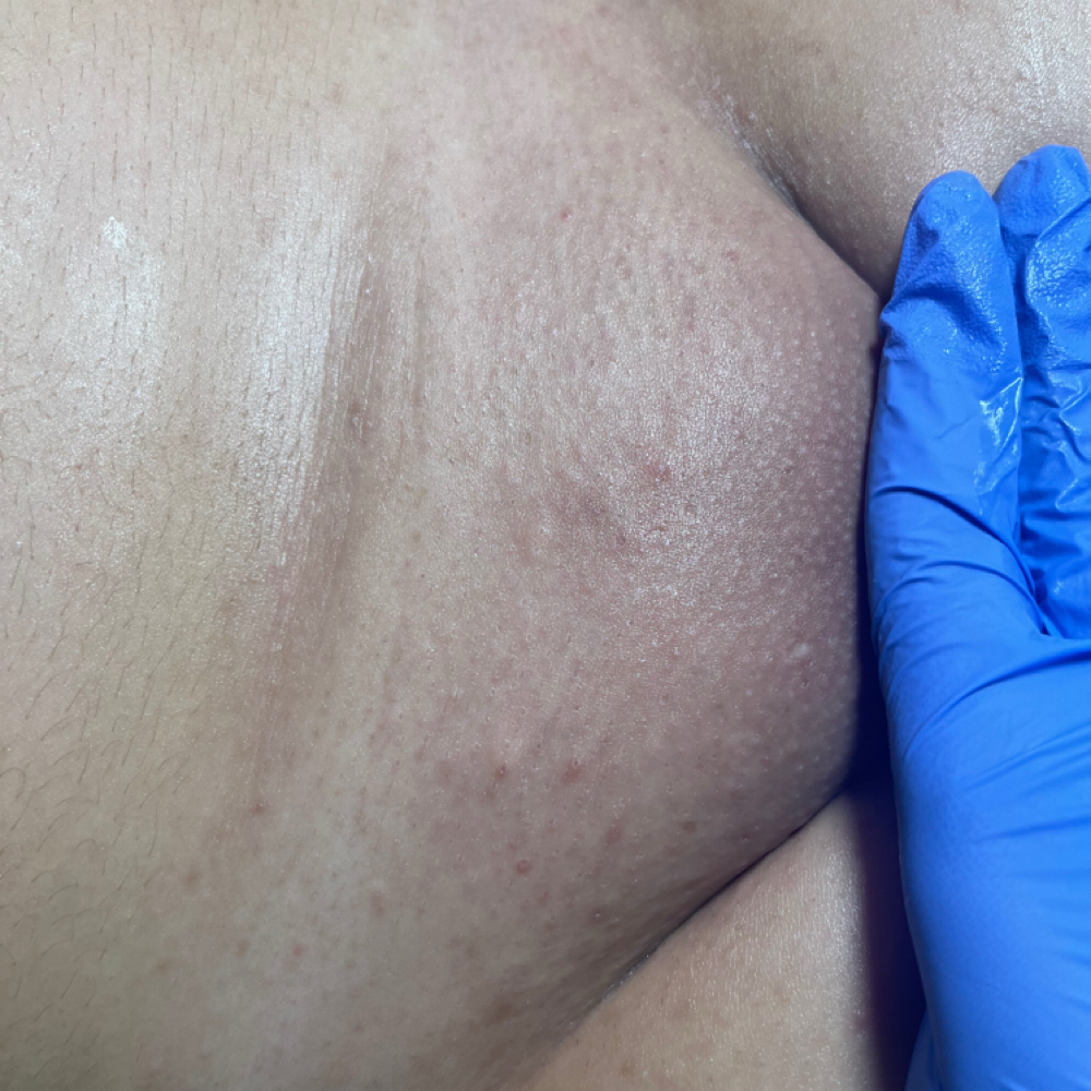 Brazilian Wax at The Groovy Esthy in Elizabeth, NJ