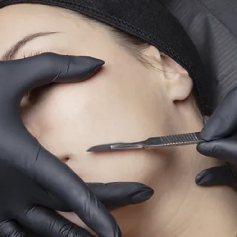 Dermaplaning