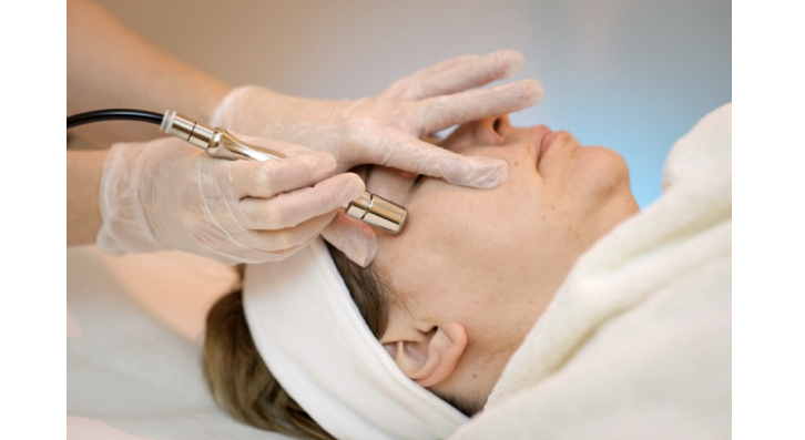 Microdermabrasion