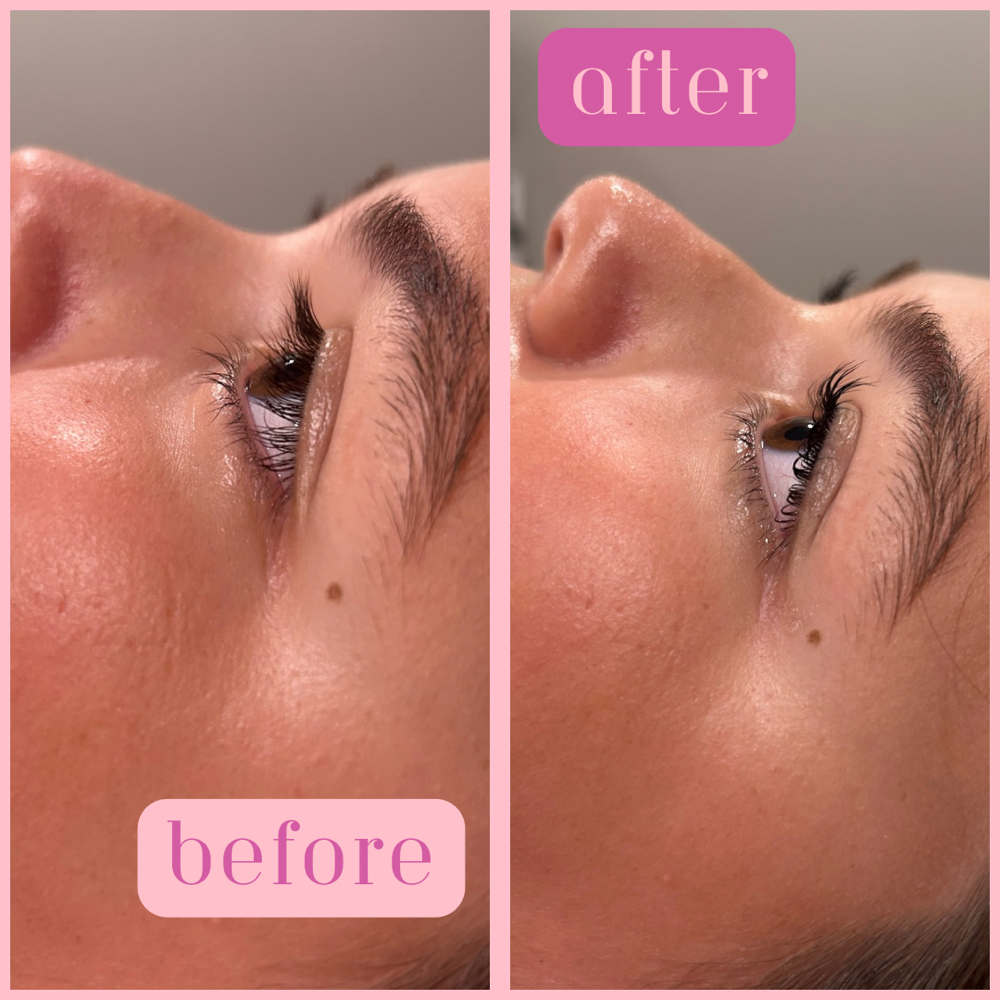 Lash lift