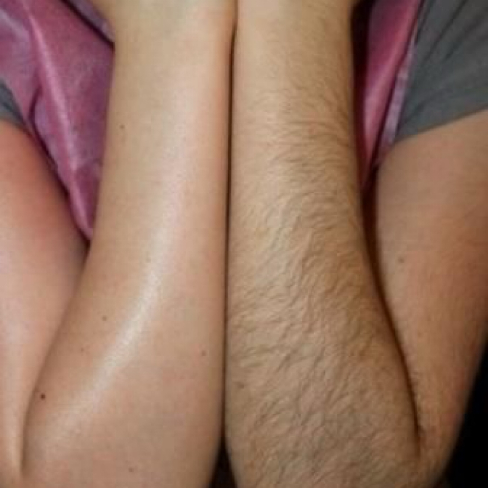 Arm Wax