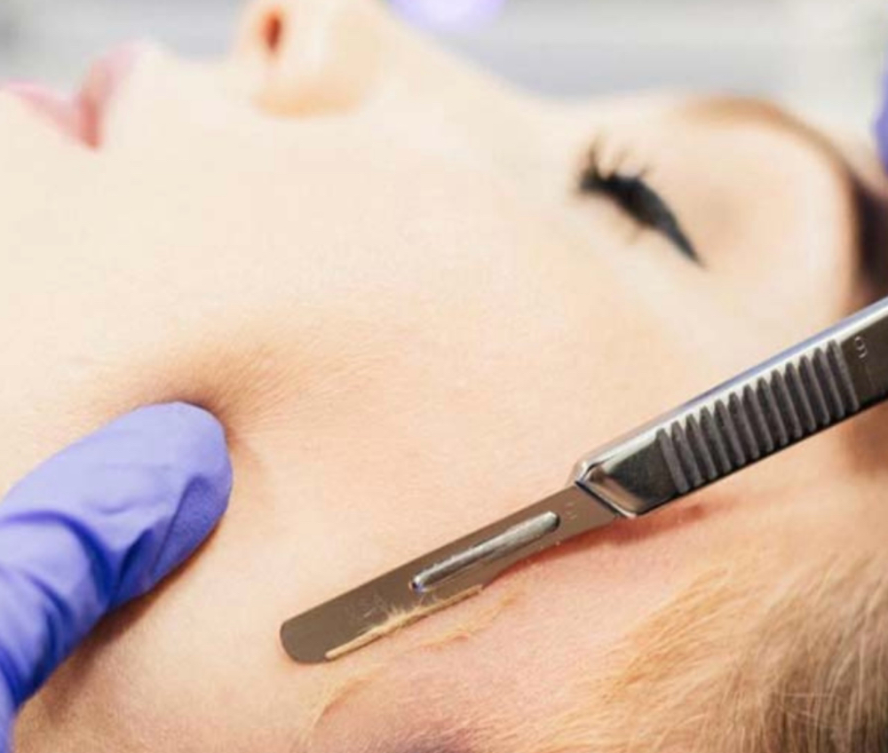 Dermaplane