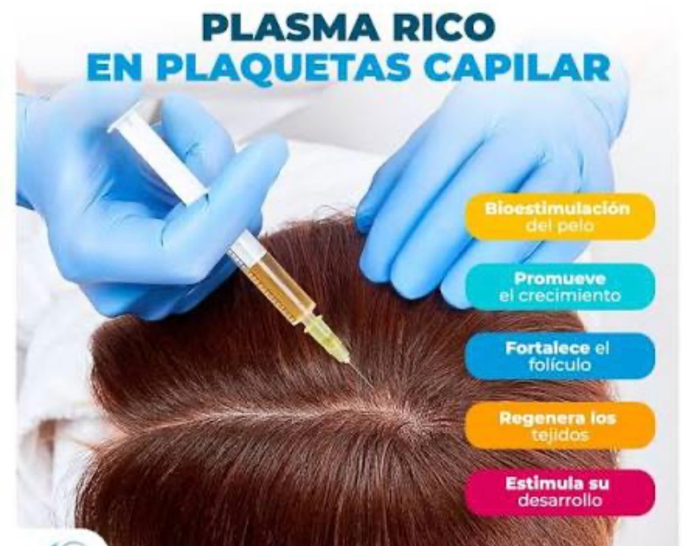 Tratamiento Capilar PRP at Dream Body Esthetic in Orlando, FL