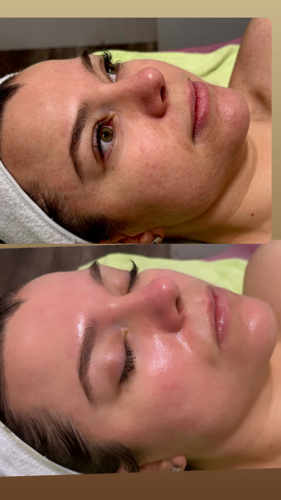 Anti-aging Facial