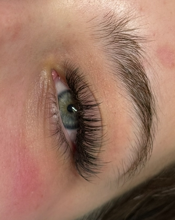 Hybrid Volume Set