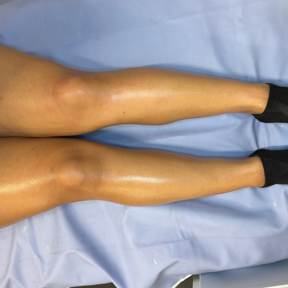 💣 Half Leg Wax at B Bomb Beauty Esthetics in Wichita, KS