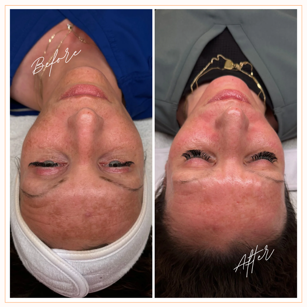 The Illuminating Facial