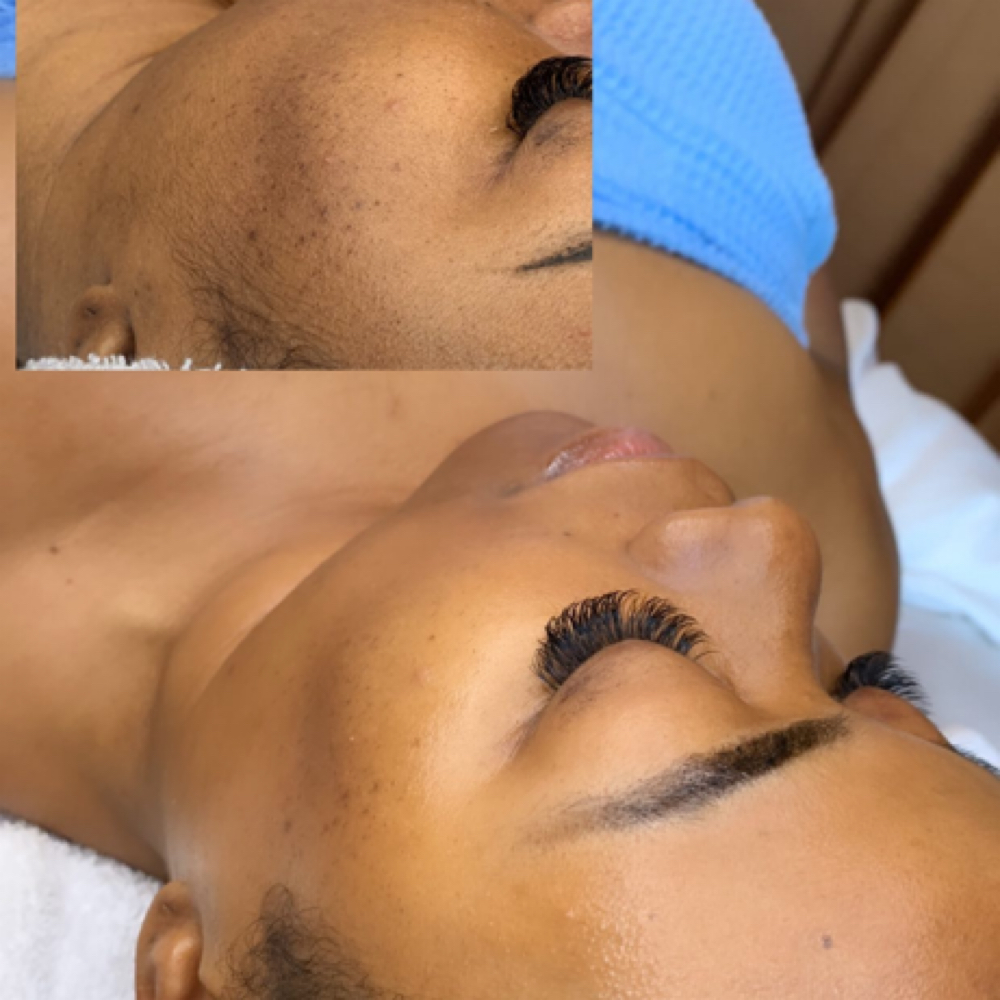 SBR Signature Facial at Sierra’s Beauty Room in Fortville, IN