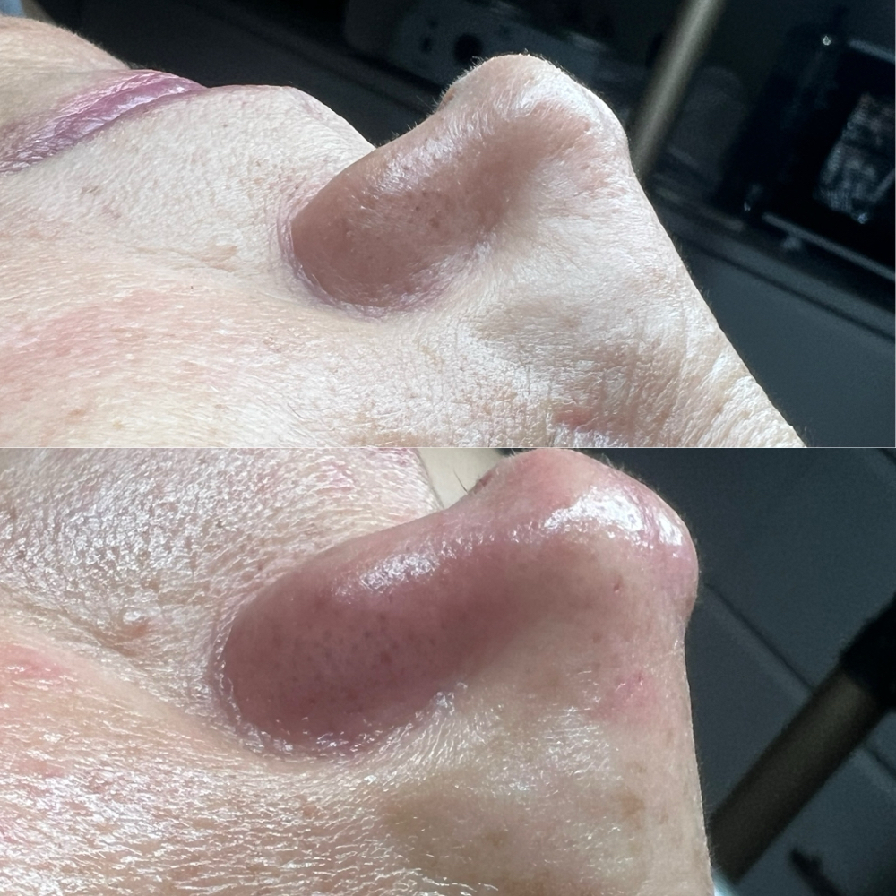 Full Face - Clarifying