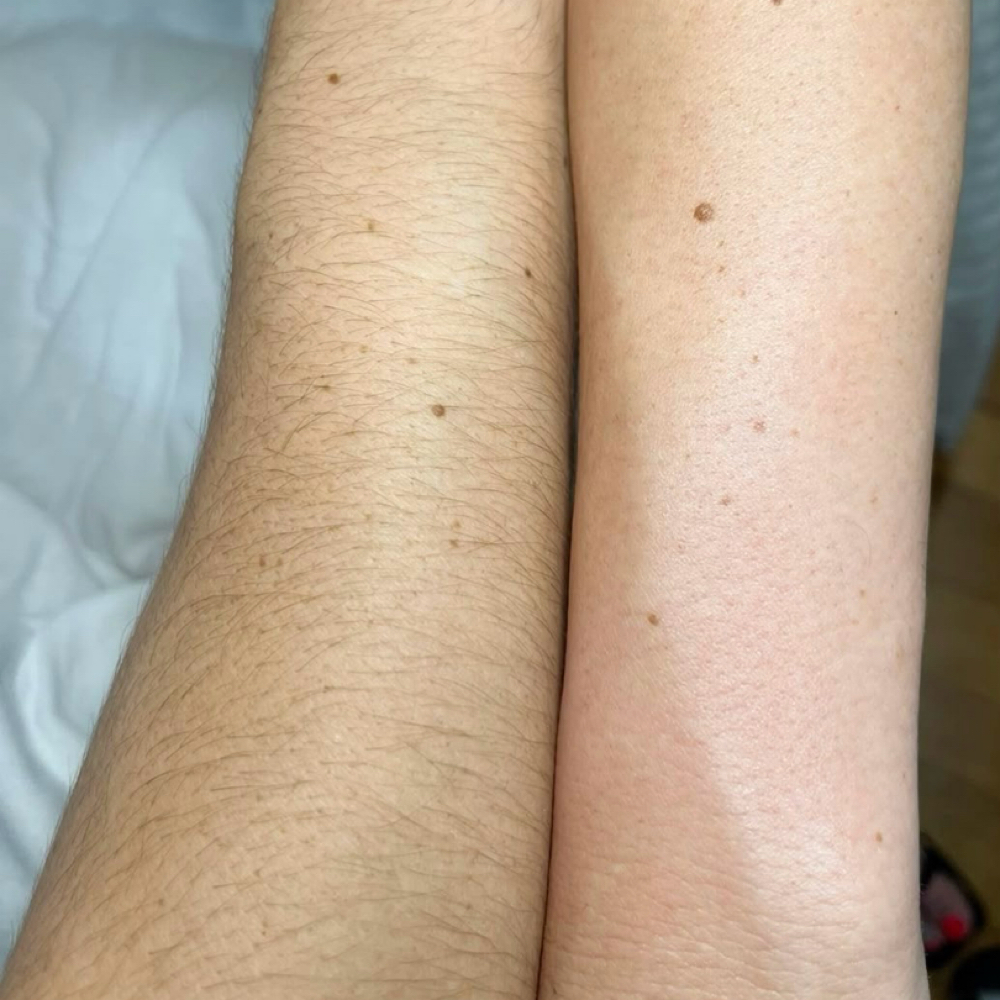 Half Arm (upper or lower) at 9TwentyNine Waxing Co. in Arlington, TX