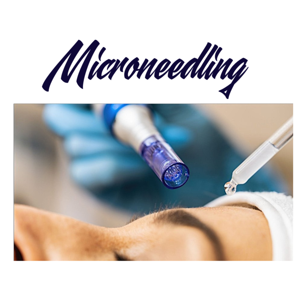 Microneedling at Royal Esthetics & Wellness in Oro Valley, AZ