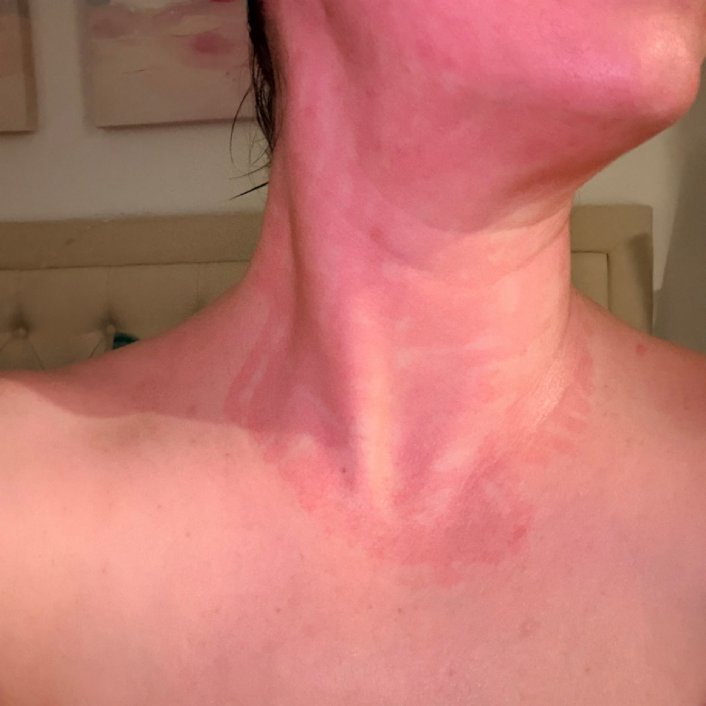 MicroNeedling (prac)FULL PRICE SOON at H2 Beauty LLC in The Village, OK