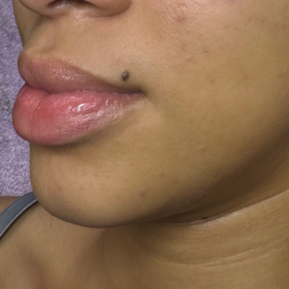 Chin Wax at Danae Esthetics in Center Line, MI