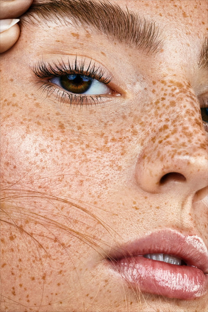 FRECKLES