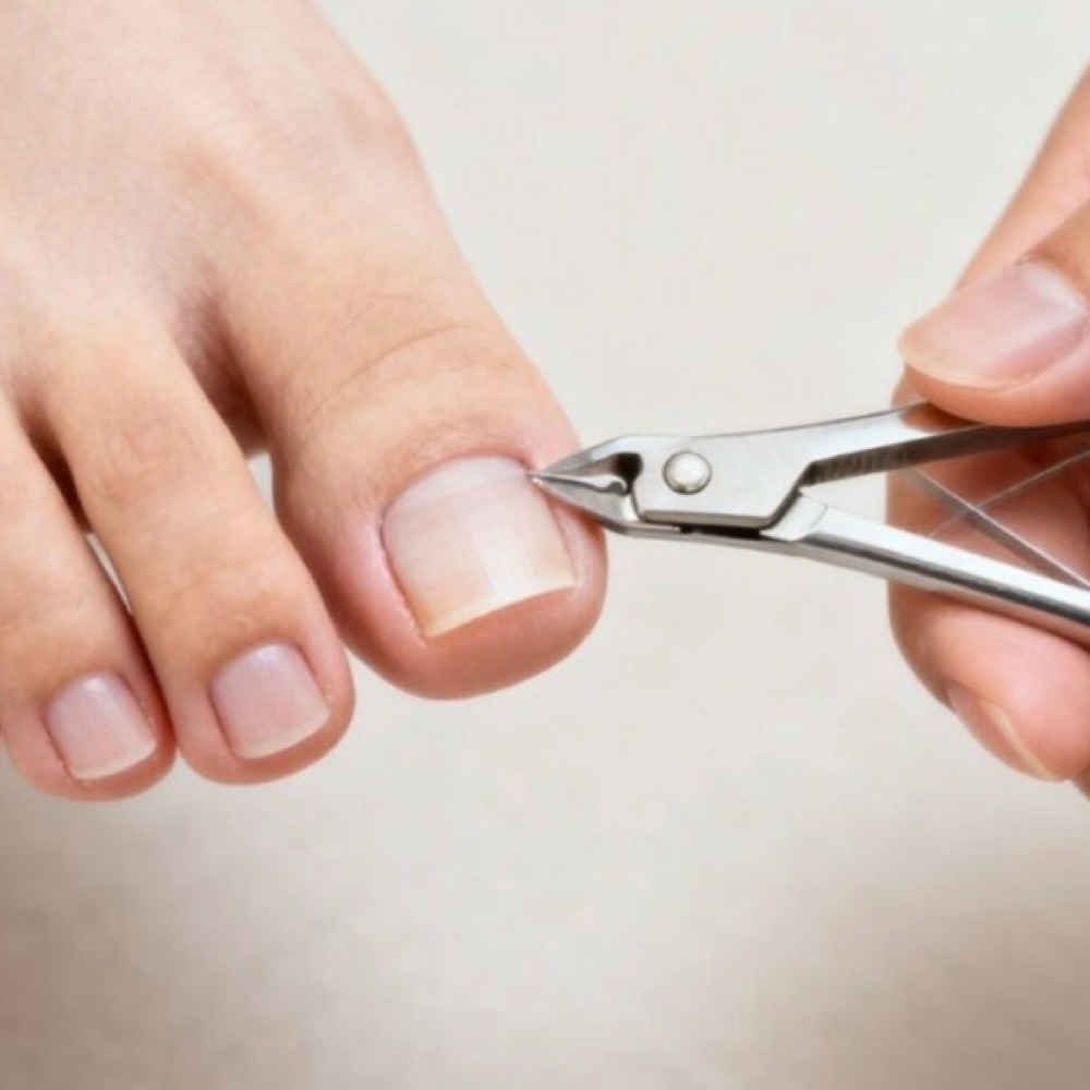 Diabetic Nail Trimming at Teas Podocenter in Ardmore, PA