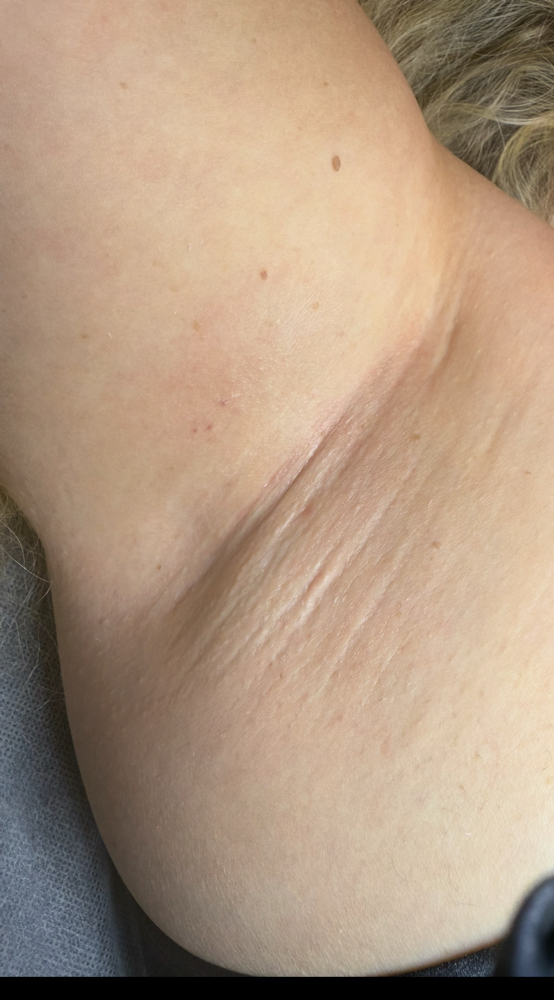 Stacy's Underarm