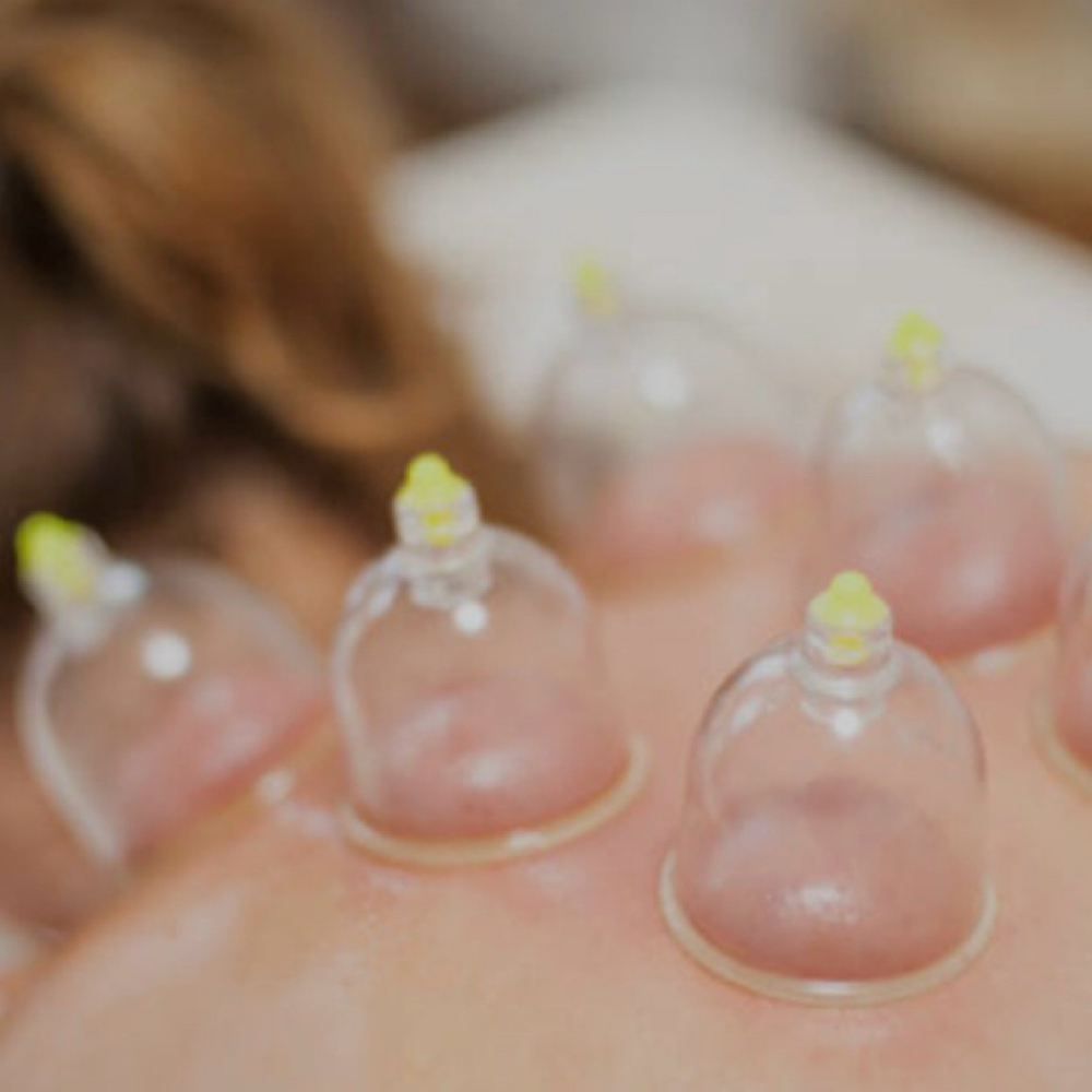 Add-on Cupping Therapy at Beach Cottage Day Spa in Seal Beach, CA