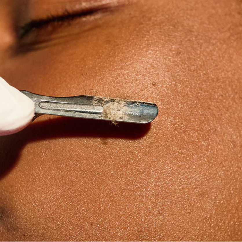The Dermaplane at Sydney Taylor Skin in Chicago, IL