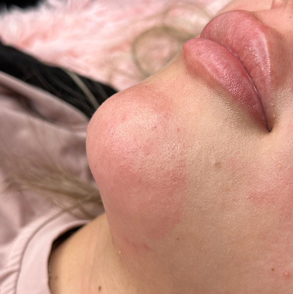 Chin Wax at Rose Beauty Bar | LLC in Lewisville, TX