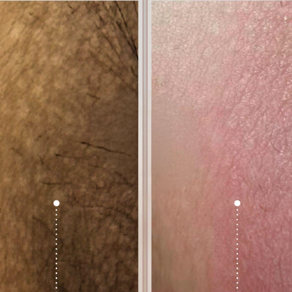 Vulva Melanin Care at Ink Beauty Studio in McAllen, TX