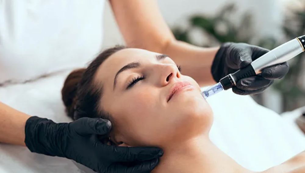 Microneedling Wednesday’s