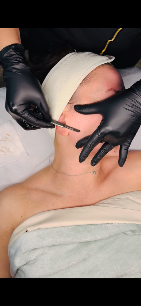 Dermaplaning Facial