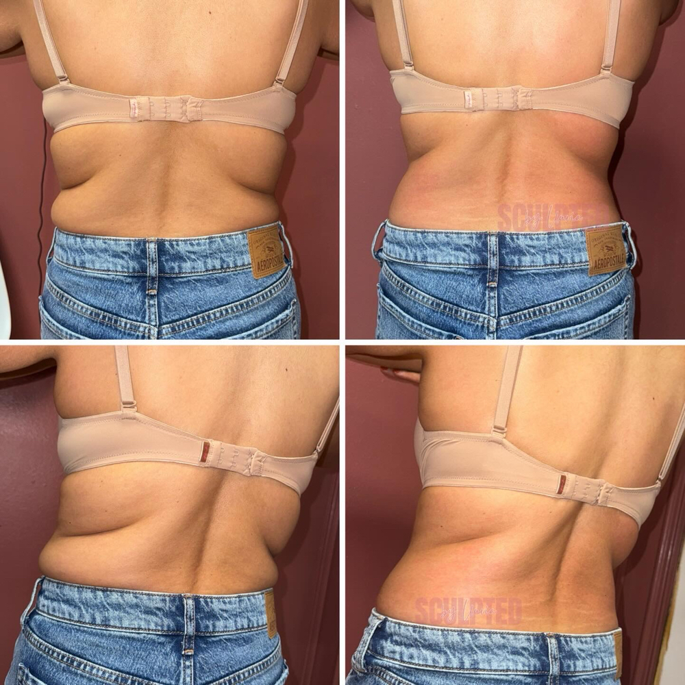 Slim Back at Sculpted by Lluvia in Weslaco, TX