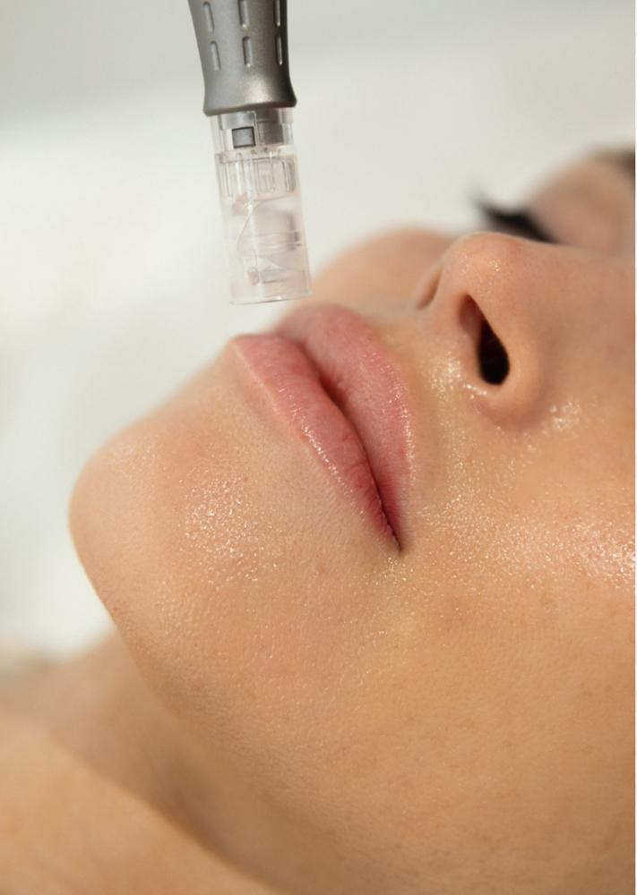 Summit Serum Infusion