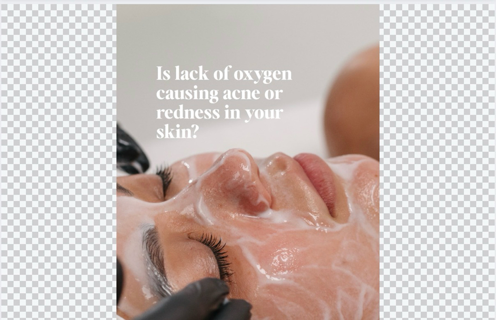 Circadia Oxygen RX Facial.