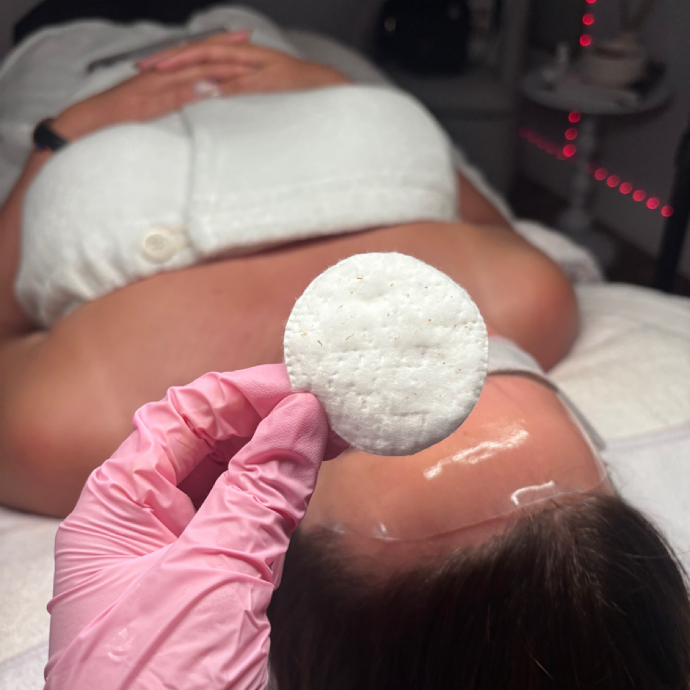 Deep Facial + Microdermabrasion at Adri_beautyskincare in Miami Lakes, FL