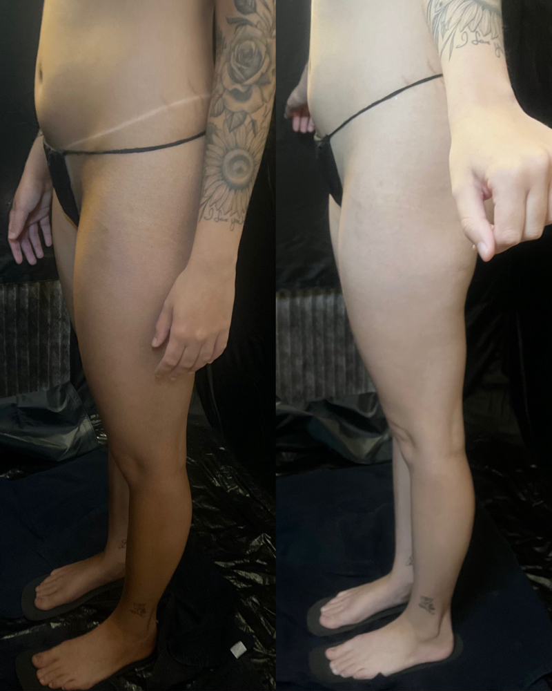 Spray Tan
