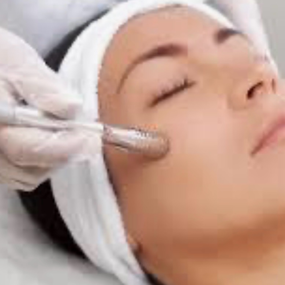 Radiance Microdermabrasion Yonka at Maggie Reese’s Spa Retreat in Ca, CA