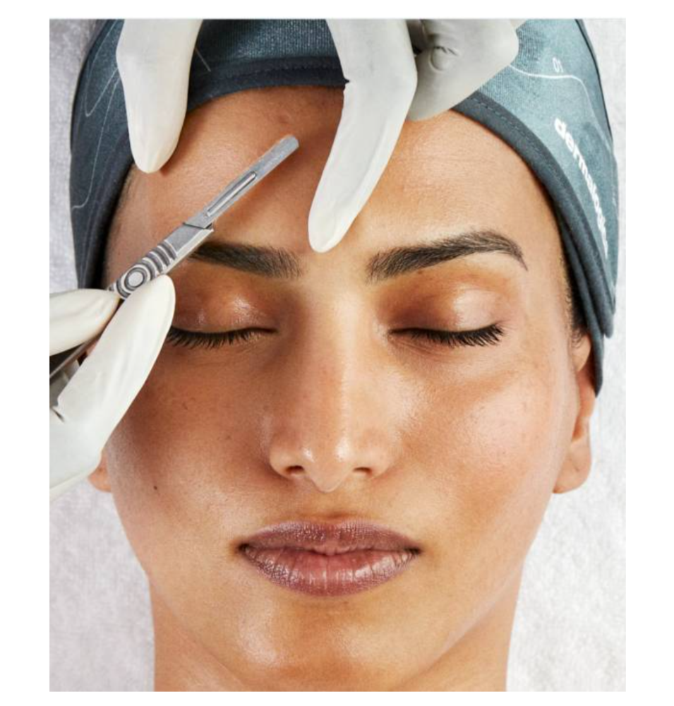 Dermaplaning