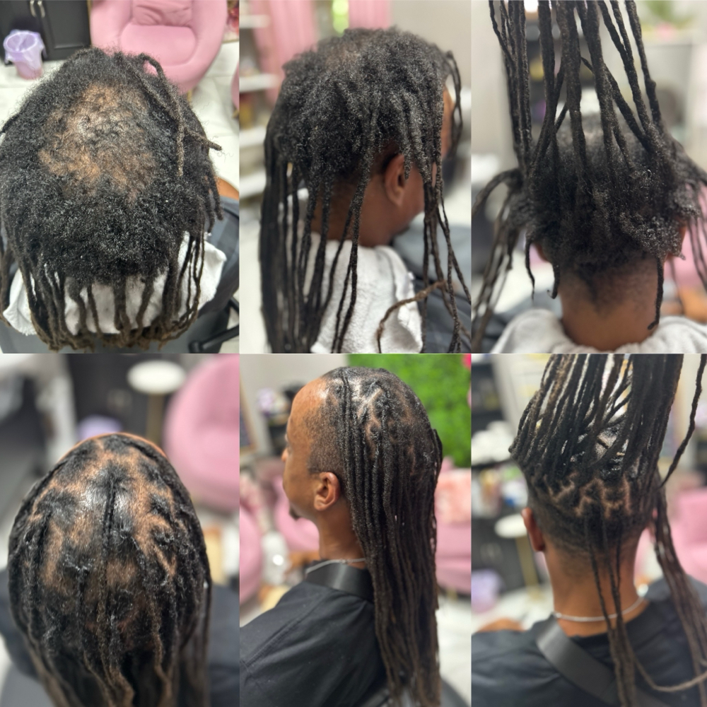 Loc Reconstruction (Full Head)