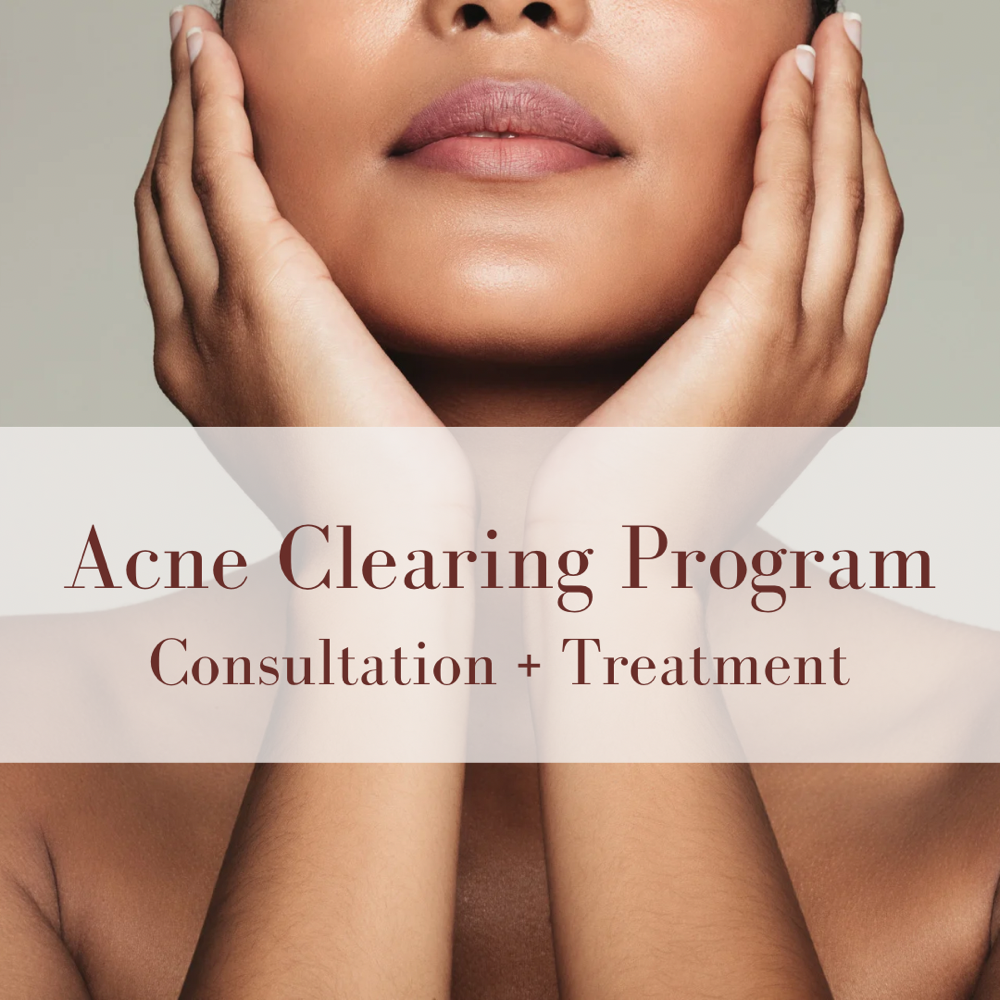 Acne Clearing Program