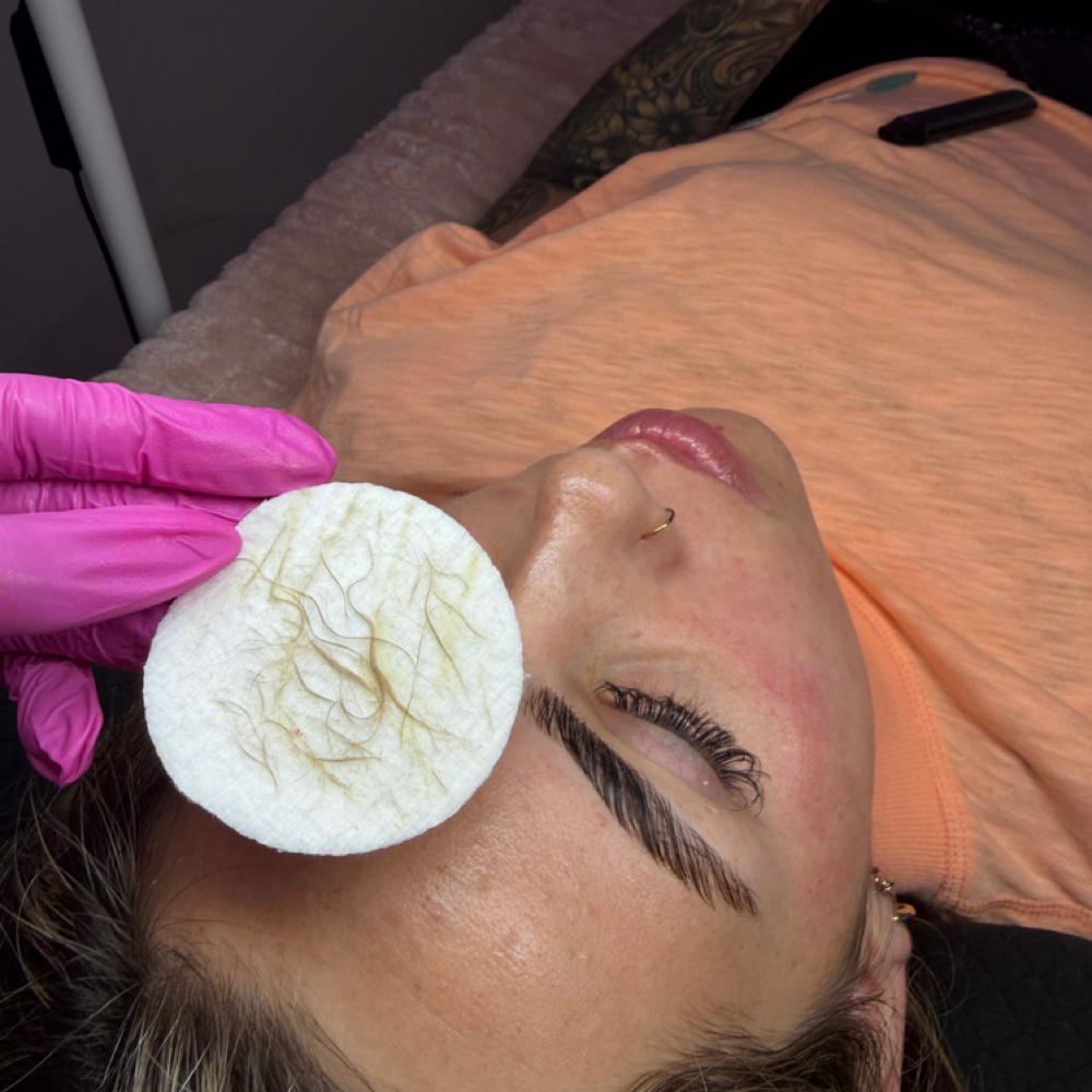 Dermaplaning at C Beauty Bar Aesthetic in Abilene, TX