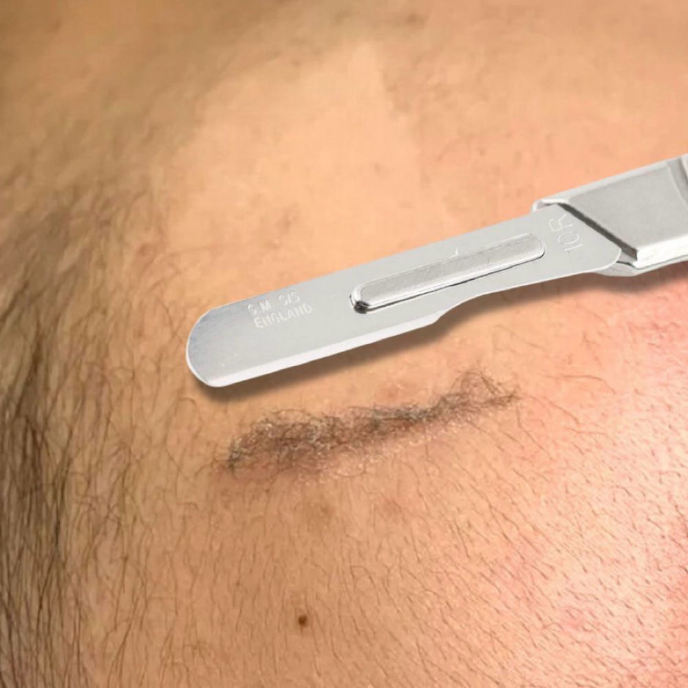 Dermaplaning at C Beauty Bar Aesthetic in Abilene, TX