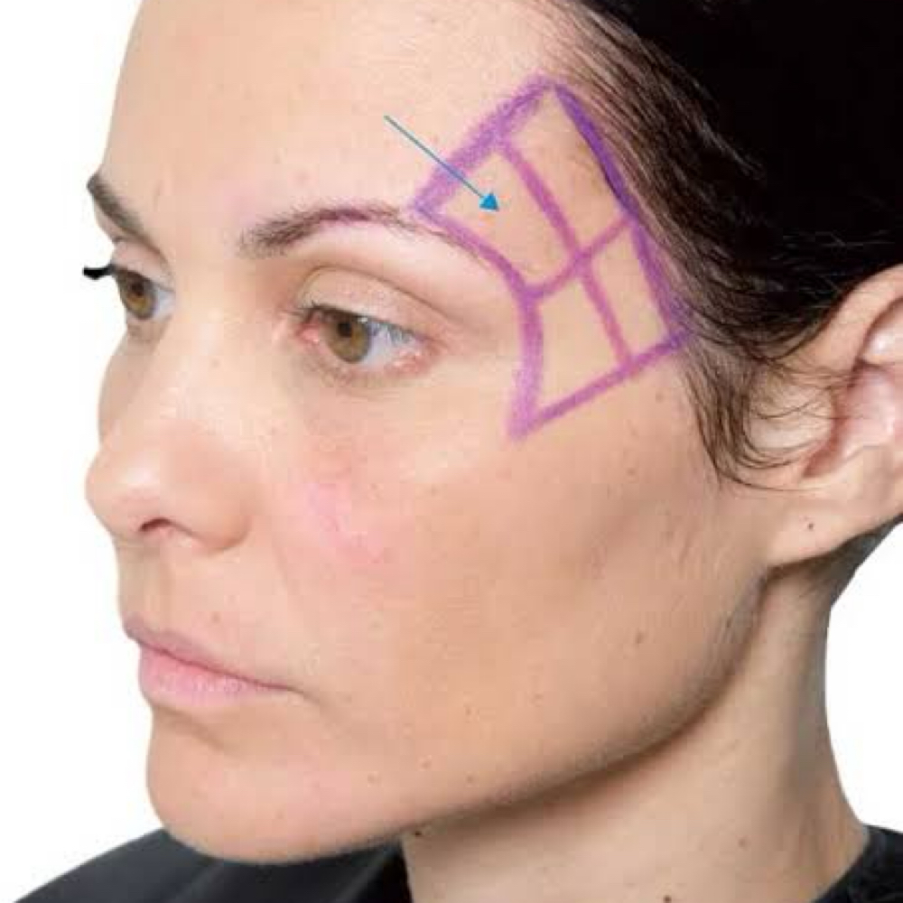 FILLER FOR HOLLOW TEMPLES at Irena Studio & Academy in McAllen, TX