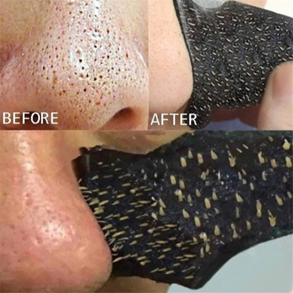 Nose Blackhead Remove
