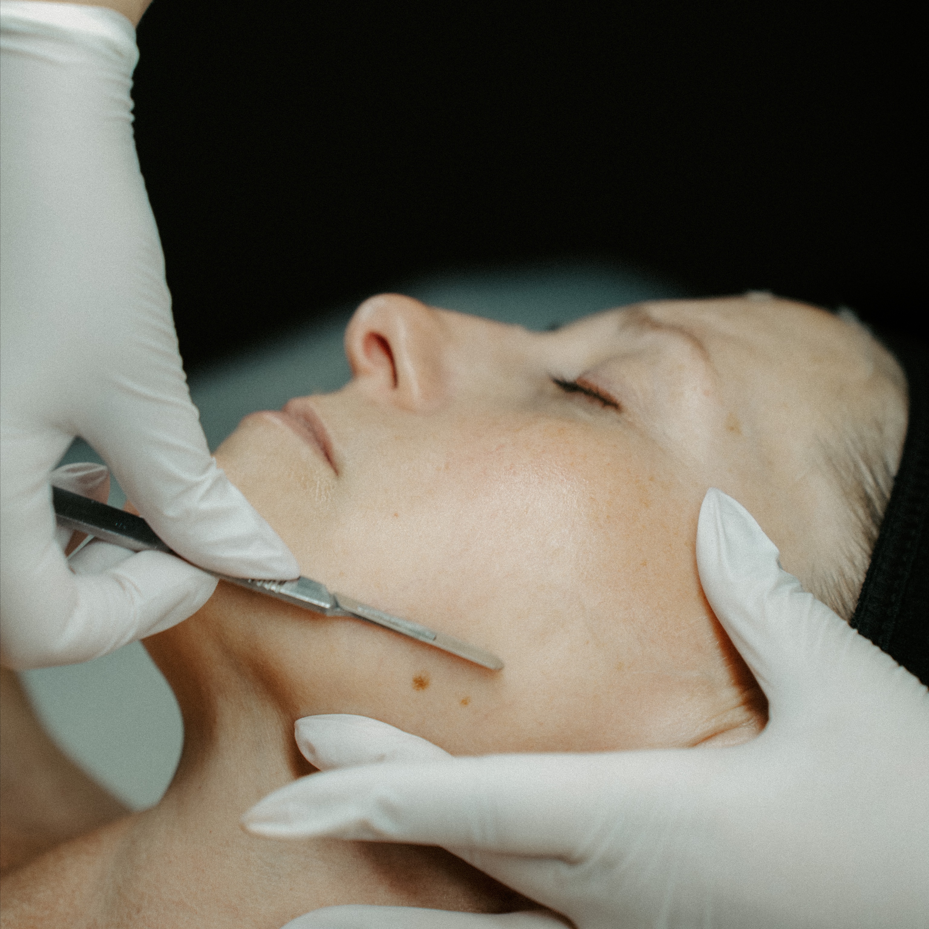 Dermaplane at Kelsey.Meraki Skincare in Lafayette, IN